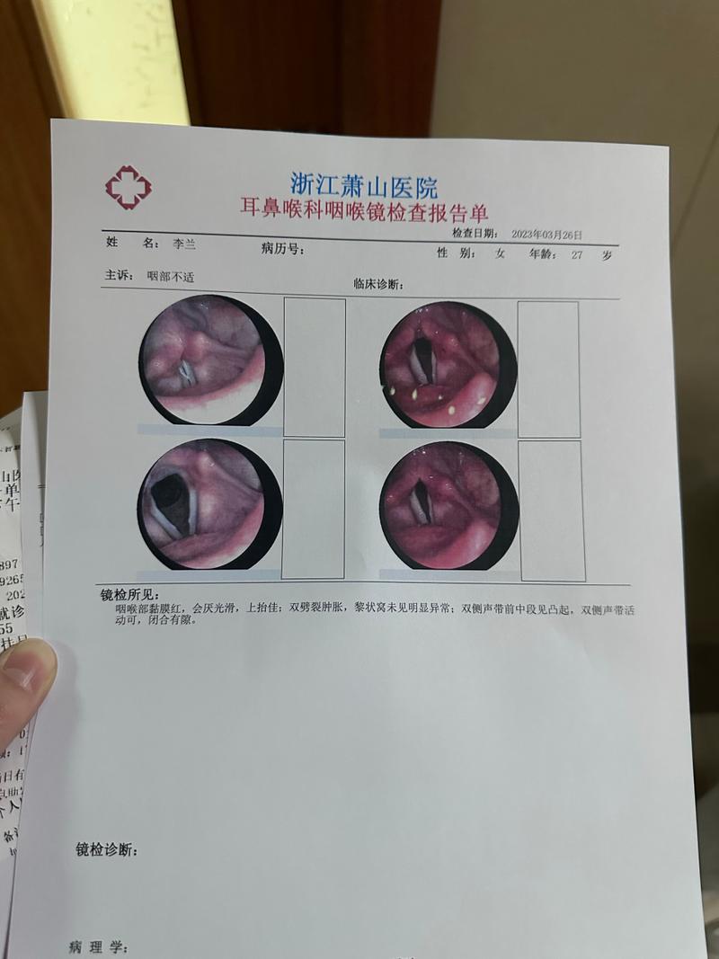 声带手术成功率解析：类型个体差异与影响